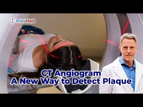 CT Angiogram, A New Way to Detect Plaque
