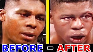 Mike Tyson's OPPONENTS - BEFORE and AFTER Fighting [2K]