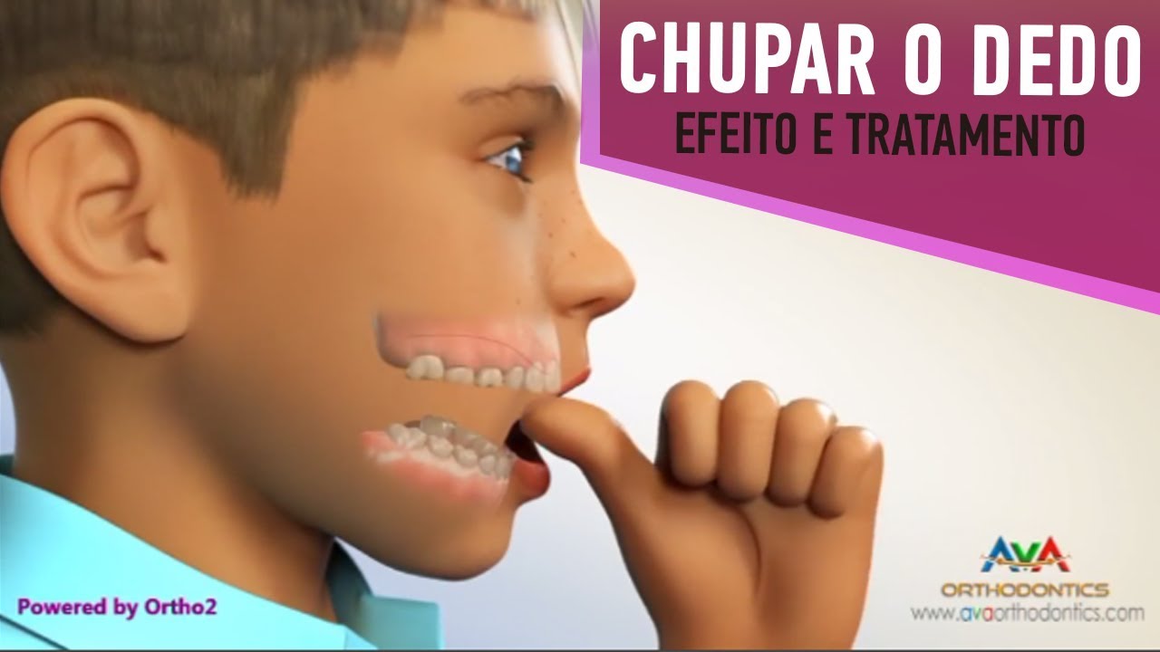 Seu Filho Chupa o Dedo