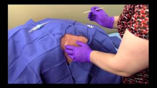 How to insert a small percutaneous chest tube (aka "pigtail")