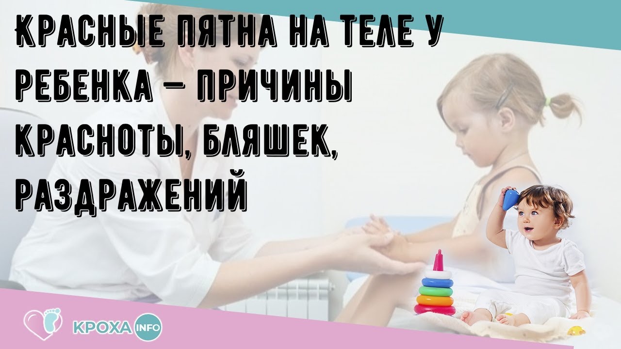 Красные пятна на теле у ребенка — причины красноты, бляшек, раздражений