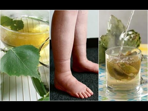 Prostatitis bei Männern Urin nicht abgehen Chirurgie da Vinci für Prostatakrebs