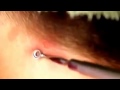 Popping Pimples Is Popping Pimples