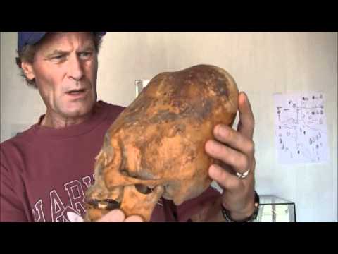 The Enigmatic Ancient Humanoid Skulls Of Paracas Peru 0