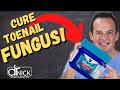 WILL VICK S VAPORUB KILL TOENAIL FUNGUS
