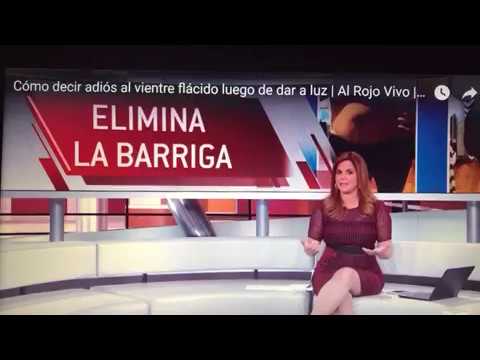 Telemundo TV Story on Diastasis Recti and the Tupler Technique