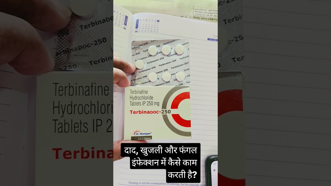 दाद-फंगल इंफेक्शन की गोली Terbinafine 250 mg | फायदे और सावधानियां