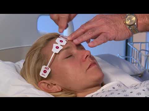 Bis 4 Electrode Sensor 186 0106 Covidien