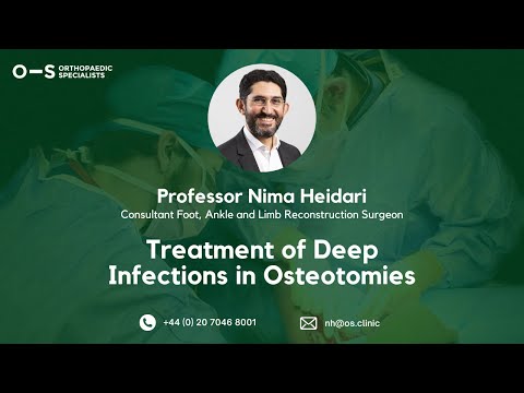 Webinar: Treatment of Deep Infections in Osteotomies | Prof Nima Heidari | Orthopaedic Specialists