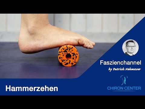 3 effektive Übungen gegen Hammerzehen