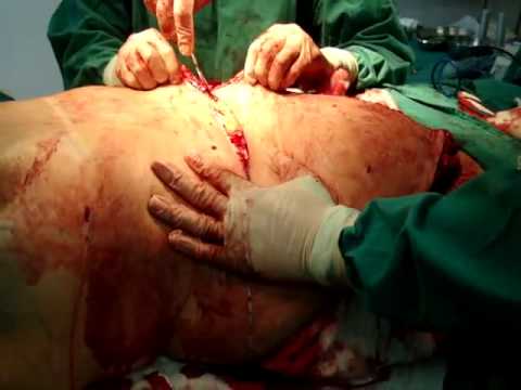 Imagem de Amostra do You Tube