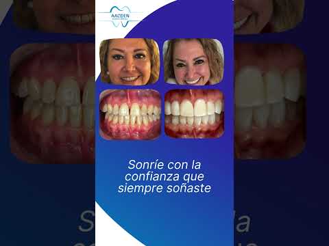 José Antonio Acosta Legorreta-4