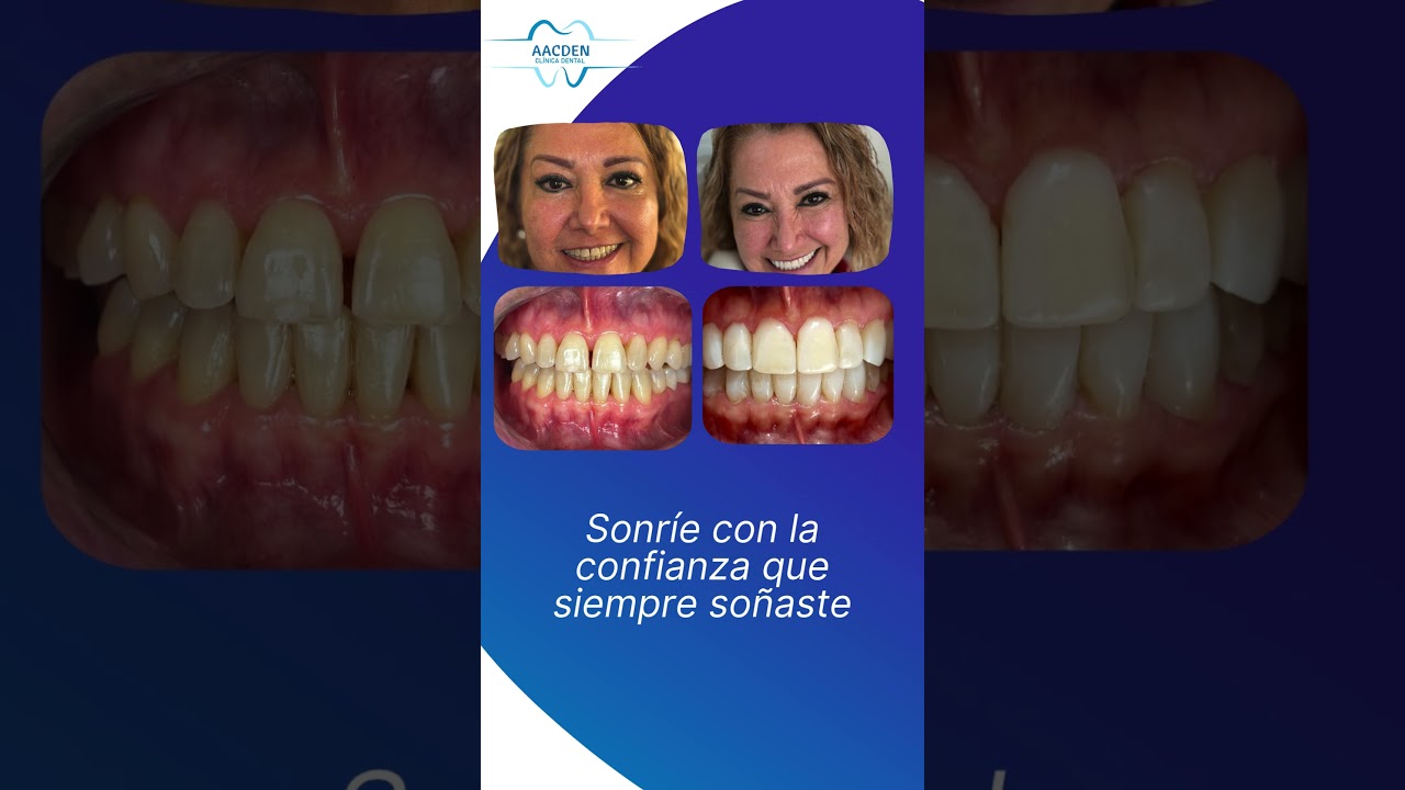 José Antonio Acosta Legorreta-4