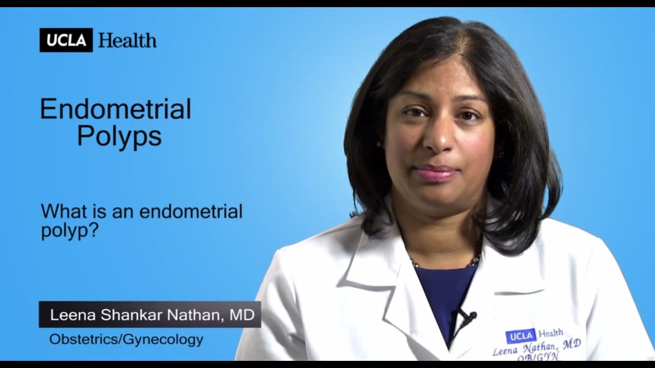 Real Questions | Endometrial Polyps | UCLA OB/GYN - YouTube