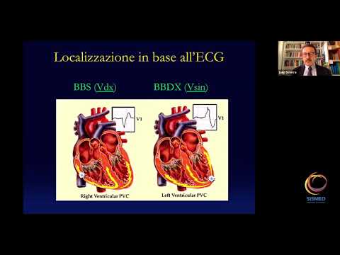 L. Sciarra - L'ECG nel paziente con aritmie ventricolari