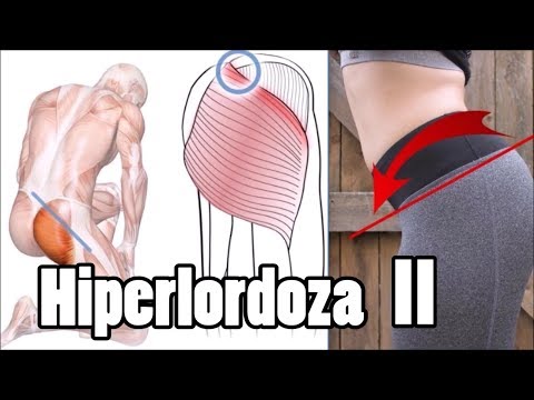 Jak rozciągnąć mięśnia czworogłowego uda Skurcze mięśnia czworogłowego