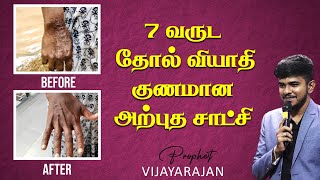 7 Years of Skin Disease Have Been Healed | Prophet Vijayarajan