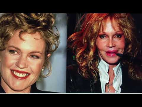 Melanie Griffith si taky ujížděla na plastických operacích!