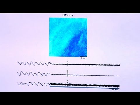 A Gentler Jolt to the Heart