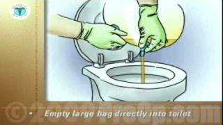 PostCare™ Patient Education Emptying a Urinary Drainage Bag