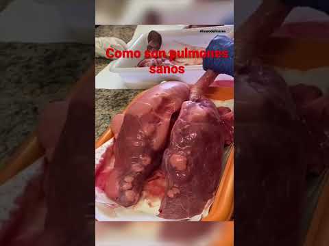 Unos pulmones 🫁 sanos.Como se hinchan lis pulmones sololando.#pulmones #shorts #reels #tiktok