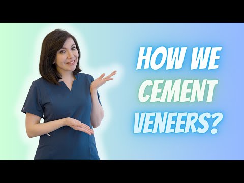Guide on How To Cement Porcelain Veneers #porcelainveneers