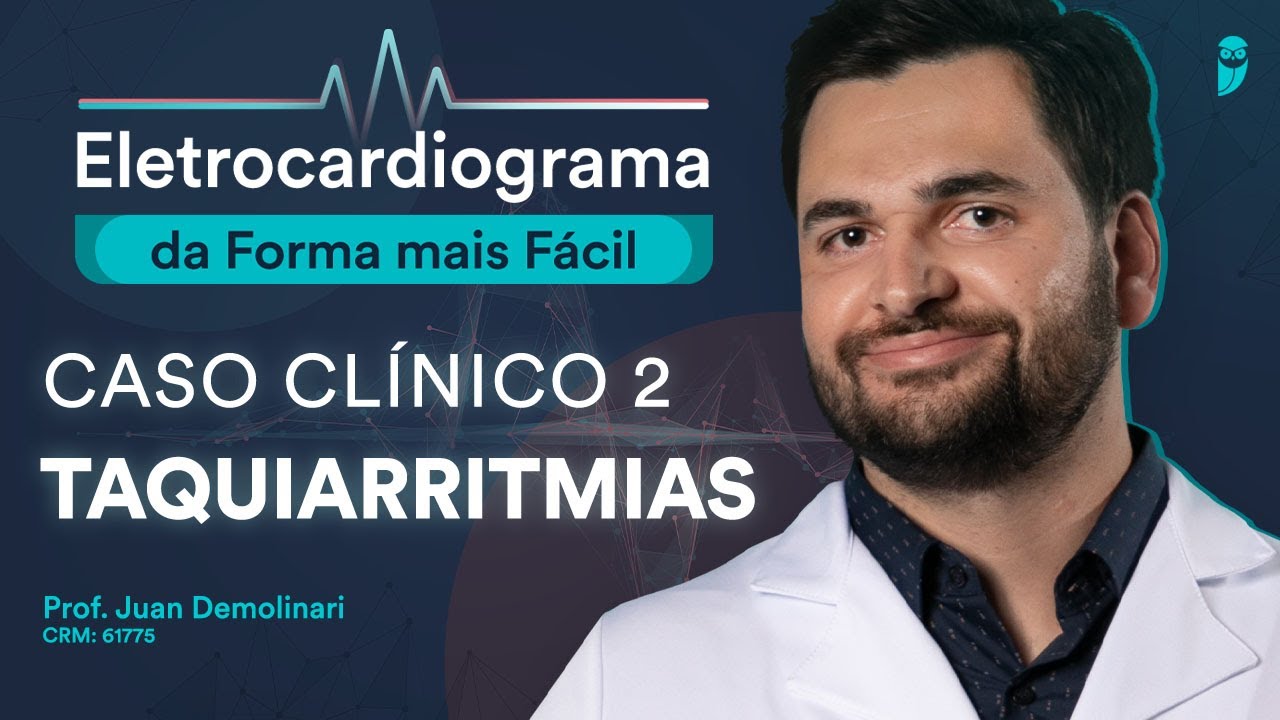 Caso Clínico 2 (Taquiarritmias) - Eletrocardiograma da Forma mais Fácil