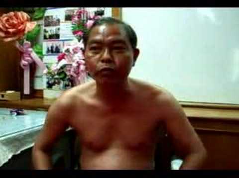 โรคสะเก็ดเงินรูปภาพจมูก โมเต็ลอีร์คุตสภูมิภาคโรคสะเก็ดเงิน