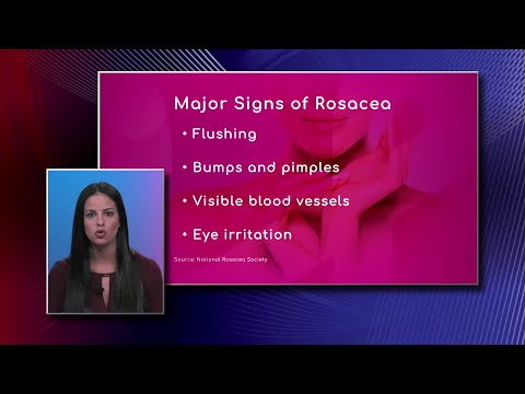 Rosacea: Signs and Symptoms