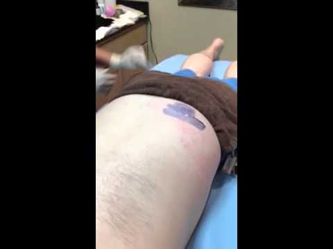 Craig's getting waxed