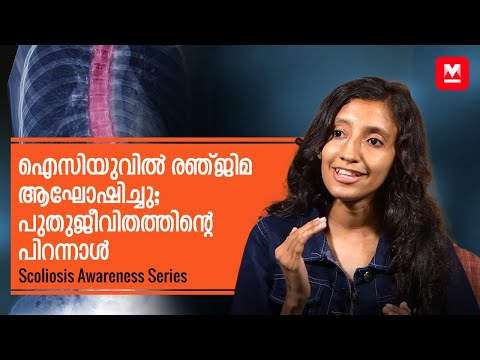 Scoliosis Awareness Series