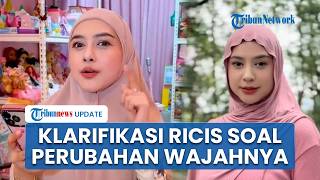 Klarifikasi Ria Ricis soal Perubahan Hidung Mancungnya Picu Spekulasi Warganet Soal Operasi Plastik