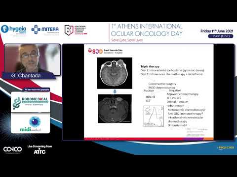 Newer treatments for retinoblastoma