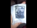 Kinoki Cleansing Pads