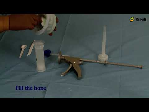 Bone Cement Injector Gun - Bone Cement Gun Latest Price, Manufacturers ...