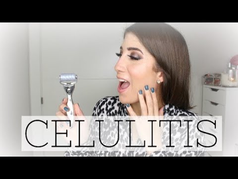 Bye bye CELULITIS!!! | Consejos para eliminar la celulitis!