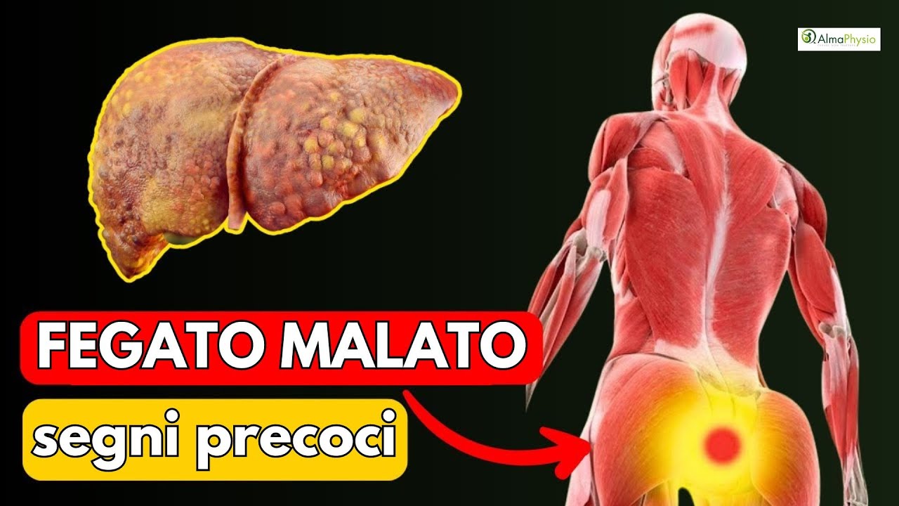 Fegato: 10 sintomi di qualcosa che non va