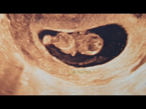 Ultrassom 8 semanas - OUVIMOS O CORAÇÃO PELA PRIMEIRA VEZ I DIÁRIO DA GRAVIDEZ