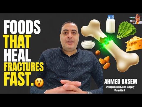 🔥 Foods That Heal Fractures FAST | Do Dairy Products Really Help?