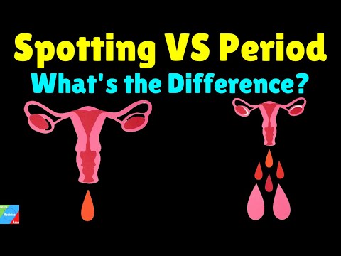 What is the difference between Spotting and Period? – Spotting VS Period