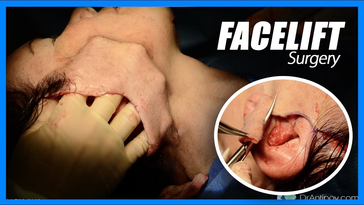 Most Popular Video 2