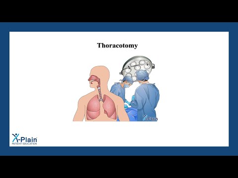 Thoracotomy
