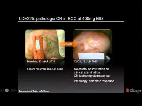 Targeting critical oncogenic pathways in cancer - emerging molecules and translational strategies