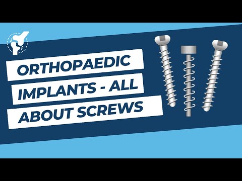 Orthopaedic Implants - All About Screws | Lag Screw | Locking Screw | Cortical & Cancellous Screws