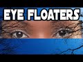 What Are Those Black Lines in My Eyes?!| EYE FLOATERS