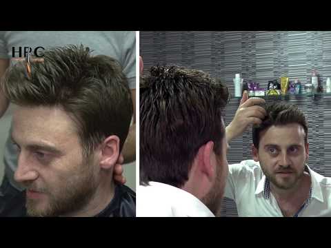 download lagu mp3 mp4 Hair Protez Center, download lagu Hair Protez Center gratis, unduh video klip Hair Protez Center