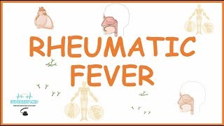Acute Rheumatic Fever: Causes, pathophysiology,symptoms,diagnosis and treatment