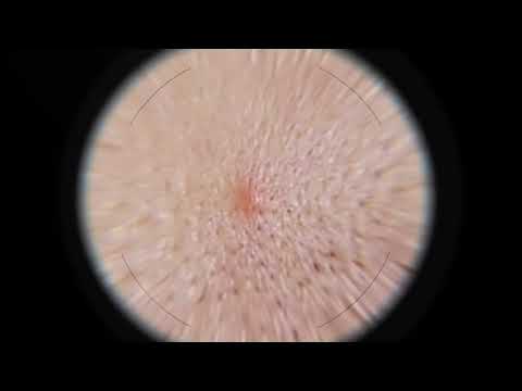 Mixa serum proti nepravilnostim