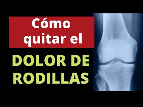 ¿Cómo Se Puede Tratar La Artrosis De Rodilla?