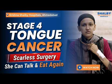 Stage 4 Tongue Cancer | Tongue-Saving Scarless Surgery | Krishna Shalby Hospital, Ahmedabad